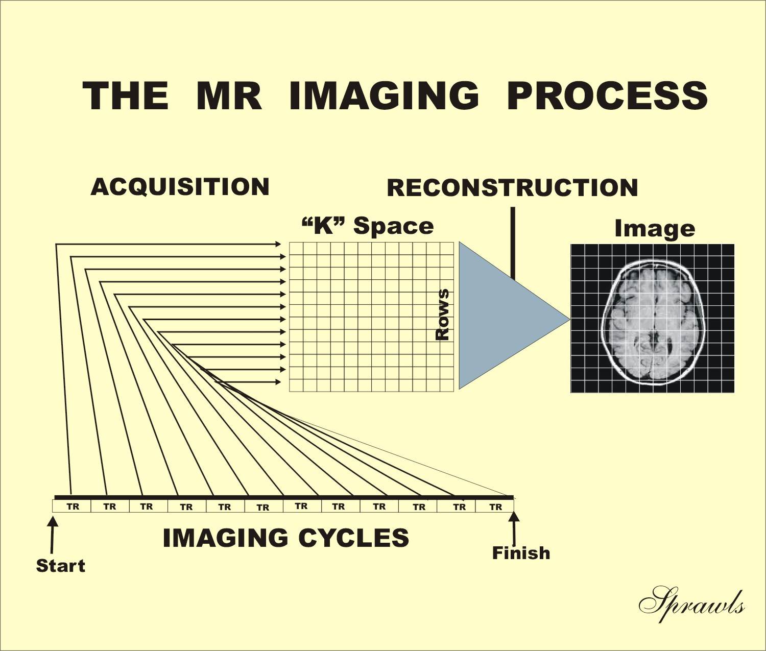 Magnetic Resonance Imaging 